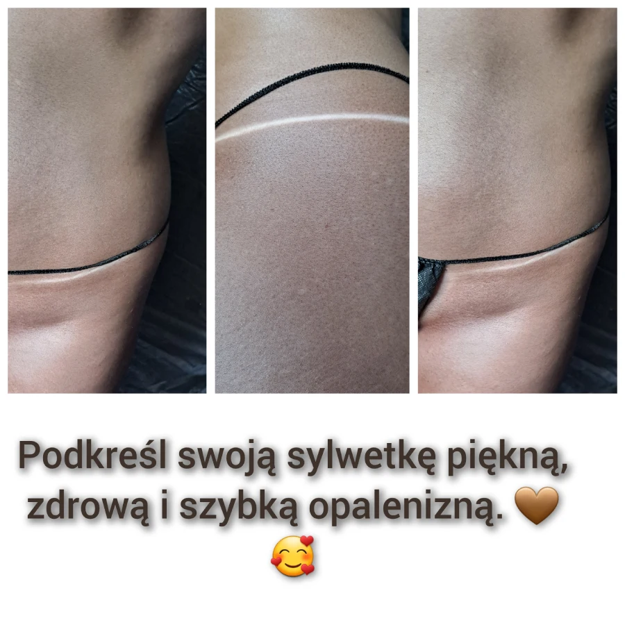 efekty opalania Ewelina Rolewicz